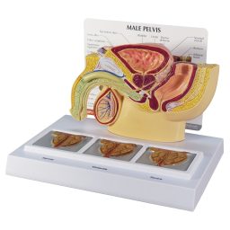 Male Pelvis Cross Section w/ Prostate Stages