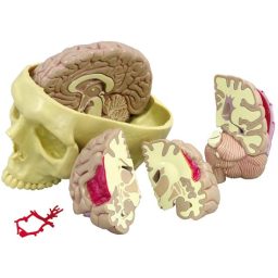 Brain Model - Half Normal & 3pc Half Pathology Sides